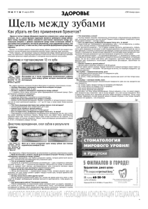 Щель между зубами - Клиника Доктора Лютикова