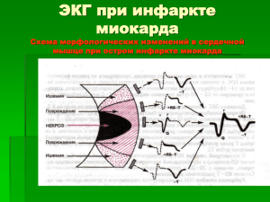 ЭКГ при инфаркте миокарда Схема морфологических изменений в сердечной