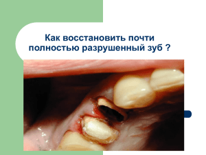 Как восстановить почти полностью разрушенный зуб ?