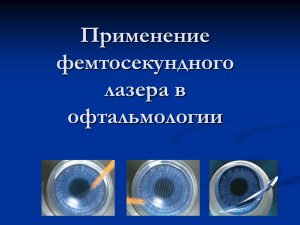Применение фемтосекундного лазера в офтальмологии