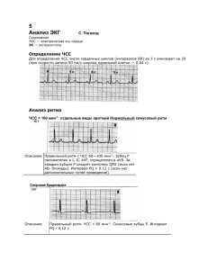 Определение ЧСС