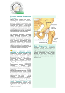 Замена бедренного сустава