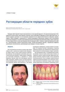 Реставрация области передних зубов