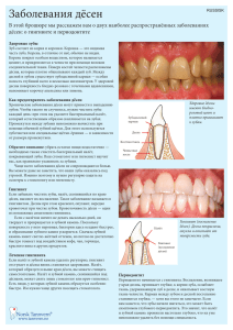 Заболевания дёсен