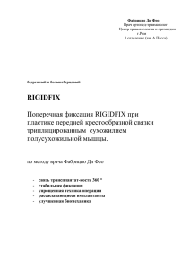 RIGIDFIX Поперечная фиксация RIGIDFIX при пластике передней