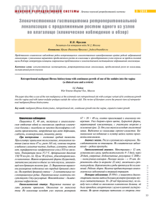 Злокачественная гистиоцитома ретроперитонеальной