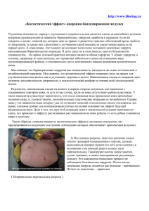 http://www.Bioring.ru «Косметический эффект» операции