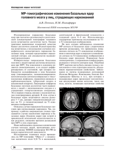 МР томографические изменения базальных ядер головного