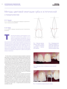 Методы цветовой имитации зуба в эстетической стоматологии