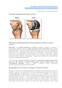 Эндопротезирование коленного сустава.