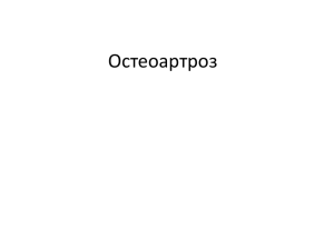 Остеоартроз