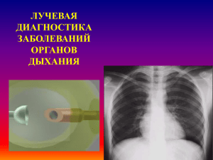 05. Лучевая диагностика заболеаваний органов дыхания