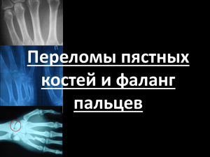 Переломы пястных костей и фаланг пальцев