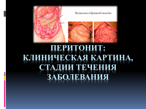 Перитонит: клиническая картина, стадии течения заболевания 