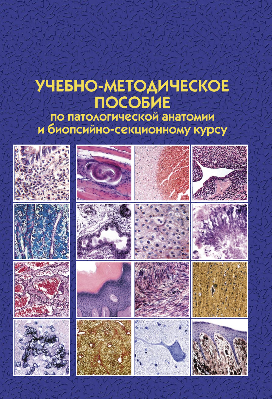 Патологическая анатомия. Патологическая_анатомия_6_е_издание. Атлас микропрепаратов по патологической анатомии. Методичка по патологической анатомии. Патологическая анатомия человека.