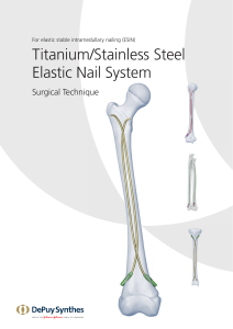 Titanium/Stainless Steel  Elastic Nail System