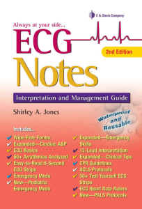 ECG-note