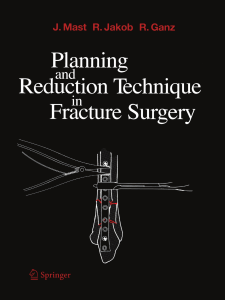 Планирование и техника вправления в хирургии переломов